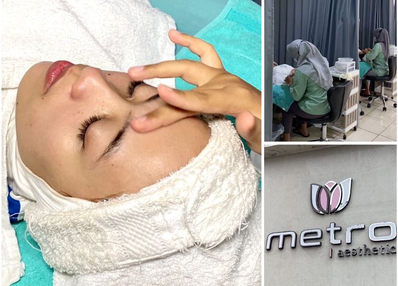 Metro Estetik, Solusi Perawatan Kulit Berkualitas dengan Keunggulan yang Melimpah